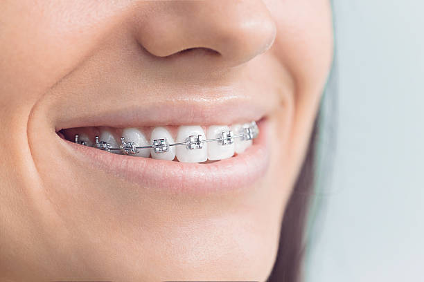 Full Mouth Reconstruction in Greensburg, PA